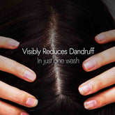 Kapiva Dandruff Control Neem Triphaladi Shampoo 250ml